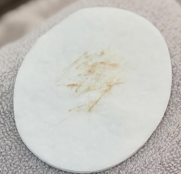 Fabulous dermaplaning result at Beauty by Bex